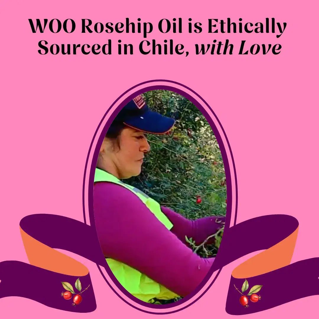 Rosehip Oil - Box Turtle